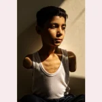 Portrait of amputee Palestinian boy from Gaza wins World Press Photo award